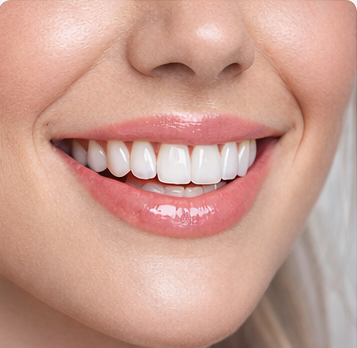 Hollywood Smile